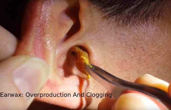 Earwax_ Overproduction And Clogging