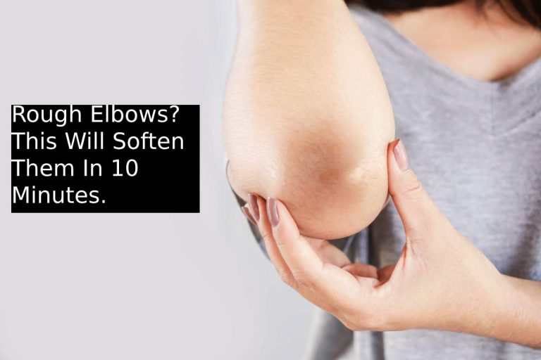 Rough Elbows? This Will Soften Them In 10 Minutes.