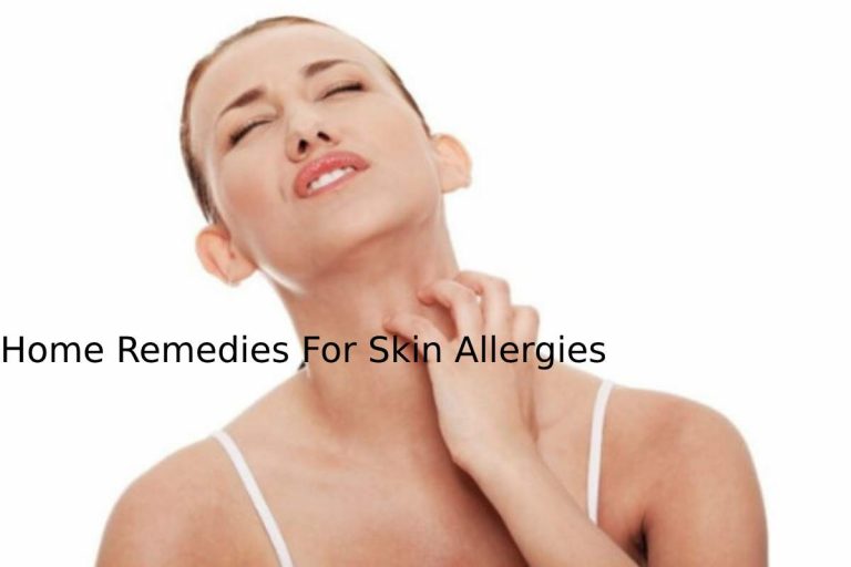 Home Remedies For Skin Allergies