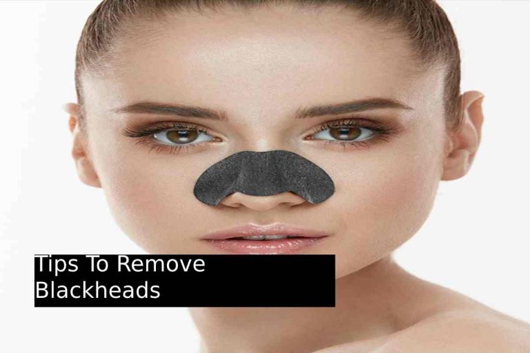 Tips To Remove Blackheads